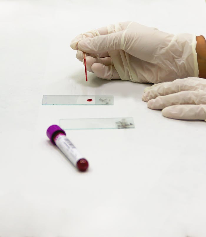 A lab technician in gloves preparing a blood sample with a microscope slide in a laboratory setting.