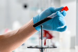 Prelievo del sangue a domicilio Messina